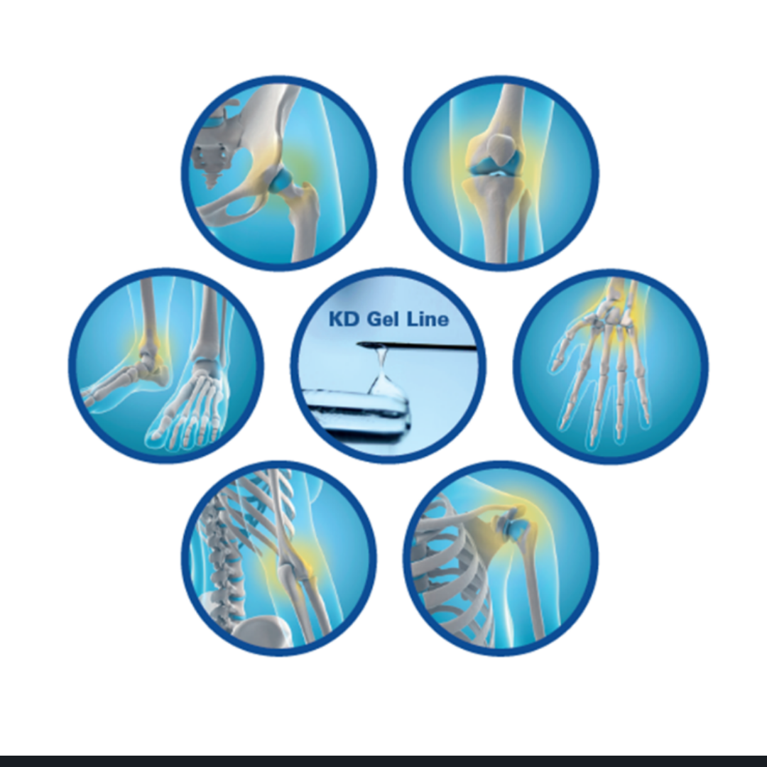 Prezentare Gel Intraarticular KD A&A Healthcare